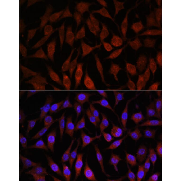 Immunofluorescence - Anti-NEDD4-2 Antibody (A16064) - Antibodies.com