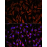 Immunofluorescence - Anti-NEDD4-2 Antibody (A16064) - Antibodies.com