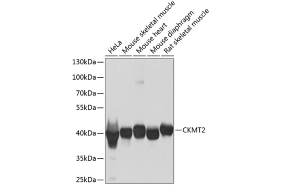 Western Blot - Anti-CKMT2 Antibody (A16065) - Antibodies.com