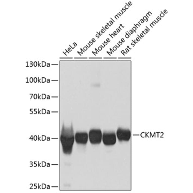 Western Blot - Anti-CKMT2 Antibody (A16065) - Antibodies.com