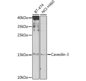Western Blot - Anti-Caveolin-3 Antibody (A16066) - Antibodies.com