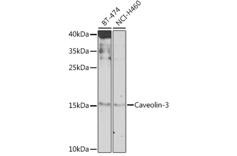 Western Blot - Anti-Caveolin-3 Antibody (A16066) - Antibodies.com