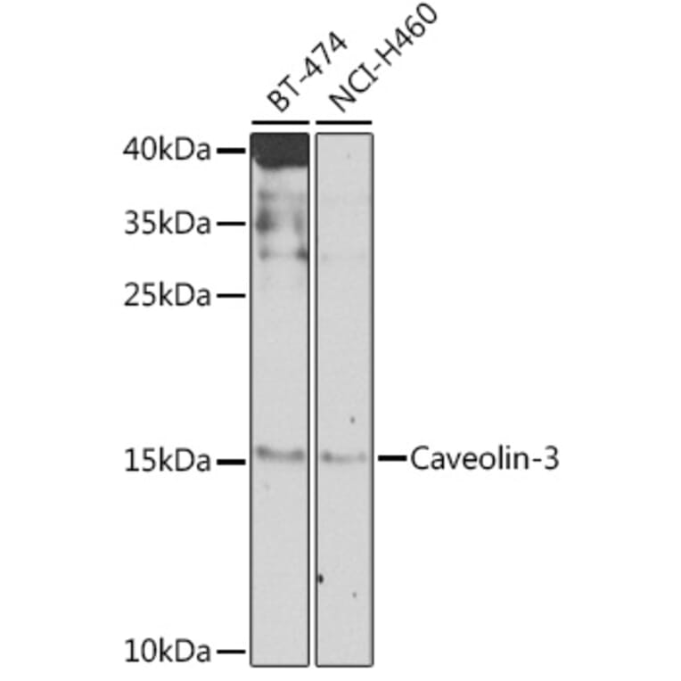 Western Blot - Anti-Caveolin-3 Antibody (A16066) - Antibodies.com