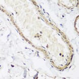 Immunohistochemistry - Anti-Caveolin-3 Antibody (A16066) - Antibodies.com