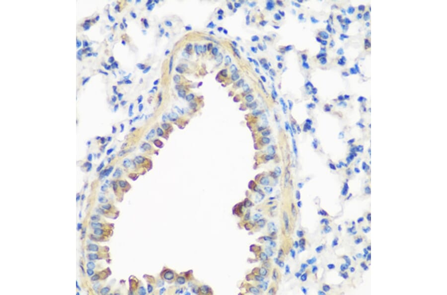 Immunohistochemistry - Anti-Caveolin-3 Antibody (A16066) - Antibodies.com