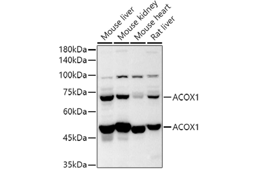 Western Blot - Anti-ACOX1/AOX Antibody (A16067) - Antibodies.com
