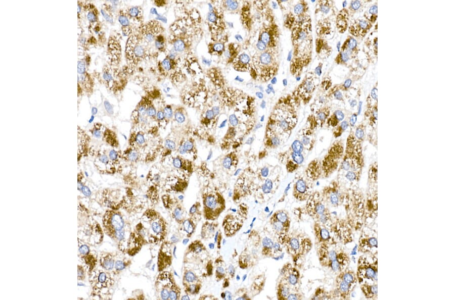 Immunohistochemistry - Anti-ACOX1/AOX Antibody (A16067) - Antibodies.com