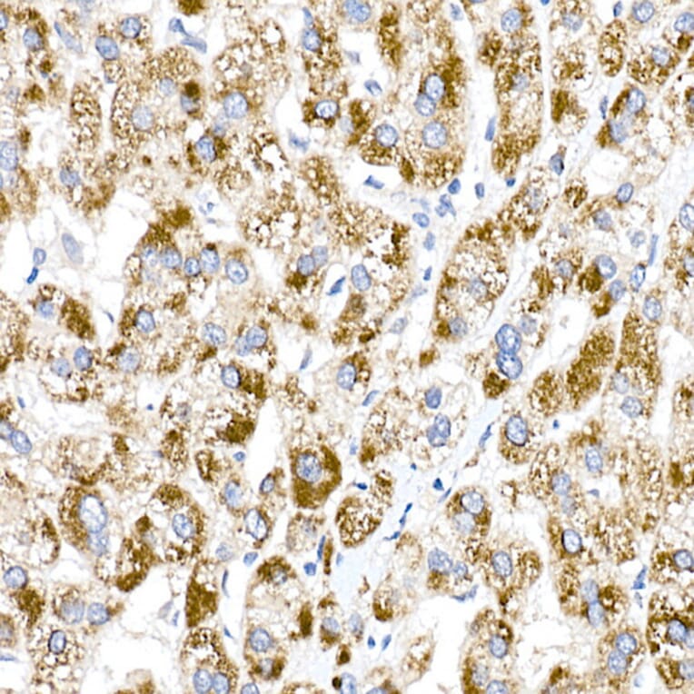 Immunohistochemistry - Anti-ACOX1/AOX Antibody (A16067) - Antibodies.com