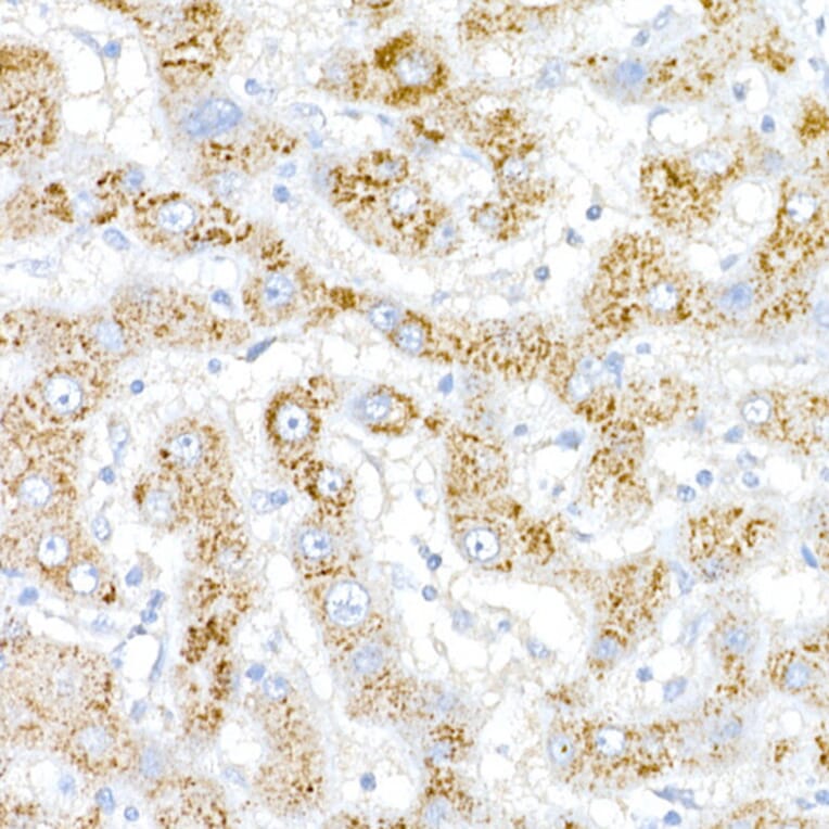 Immunohistochemistry - Anti-ACOX1/AOX Antibody (A16067) - Antibodies.com