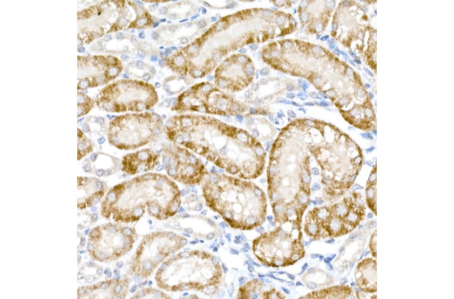 Immunohistochemistry - Anti-ACOX1/AOX Antibody (A16067) - Antibodies.com