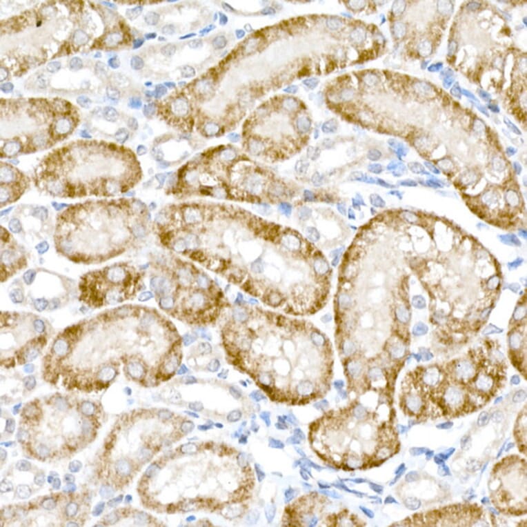 Immunohistochemistry - Anti-ACOX1/AOX Antibody (A16067) - Antibodies.com