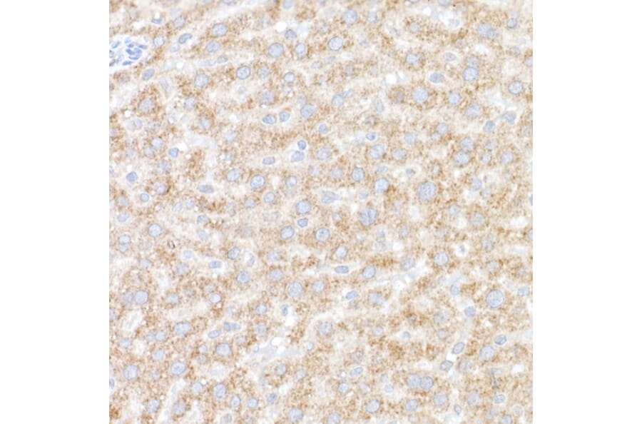 Immunohistochemistry - Anti-ACOX1/AOX Antibody (A16067) - Antibodies.com