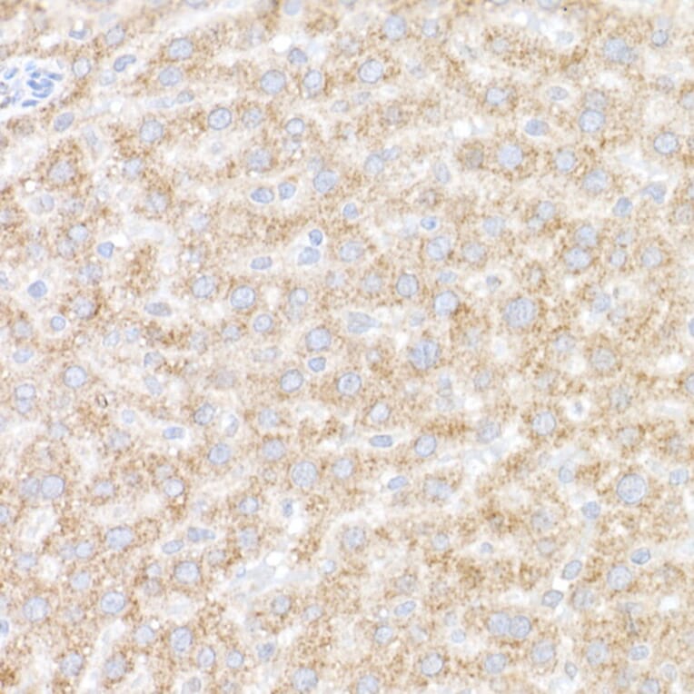 Immunohistochemistry - Anti-ACOX1/AOX Antibody (A16067) - Antibodies.com