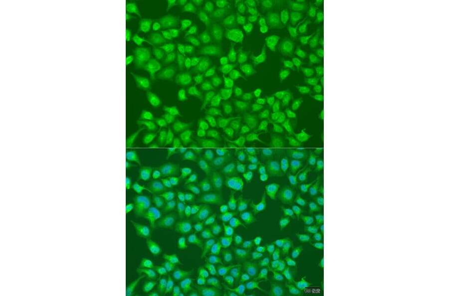 Immunofluorescence - Anti-ACOX1/AOX Antibody (A16067) - Antibodies.com
