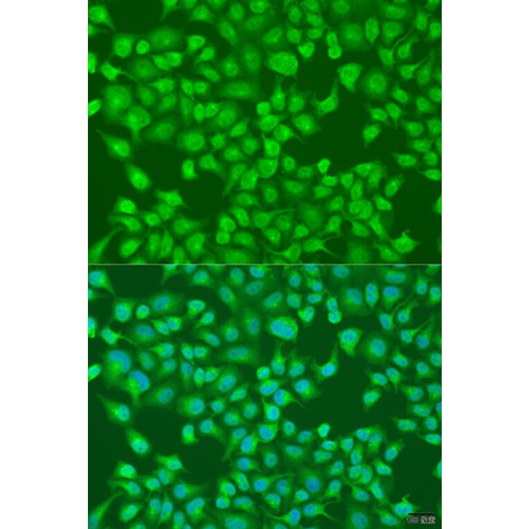 Immunofluorescence - Anti-ACOX1/AOX Antibody (A16067) - Antibodies.com