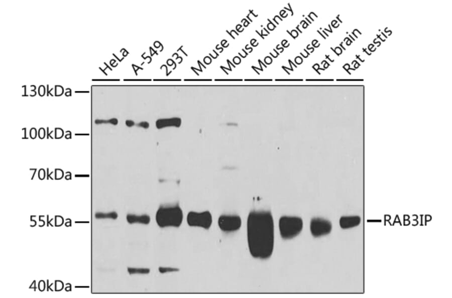Western Blot - Anti-RAB3IP Antibody (A8094) - Antibodies.com