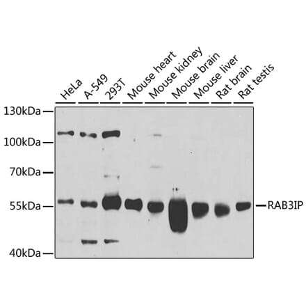 Western Blot - Anti-RAB3IP Antibody (A16068) - Antibodies.com