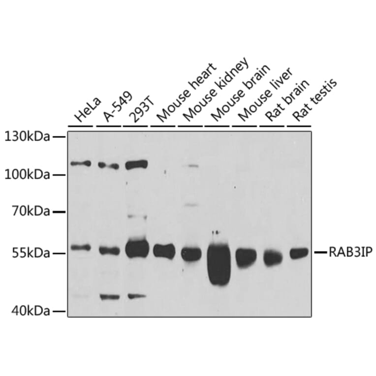 Western Blot - Anti-RAB3IP Antibody (A8094) - Antibodies.com