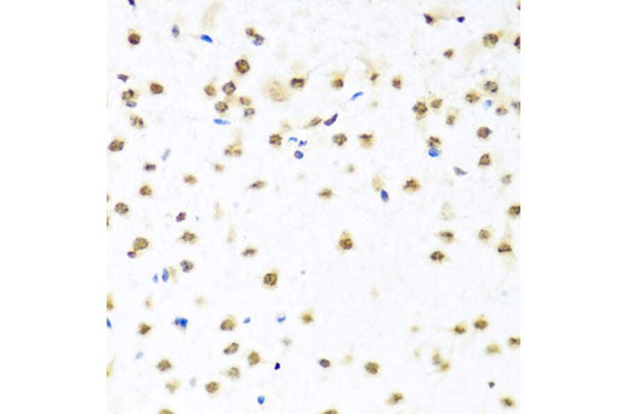 Immunohistochemistry - Anti-RAB3IP Antibody (A8094) - Antibodies.com