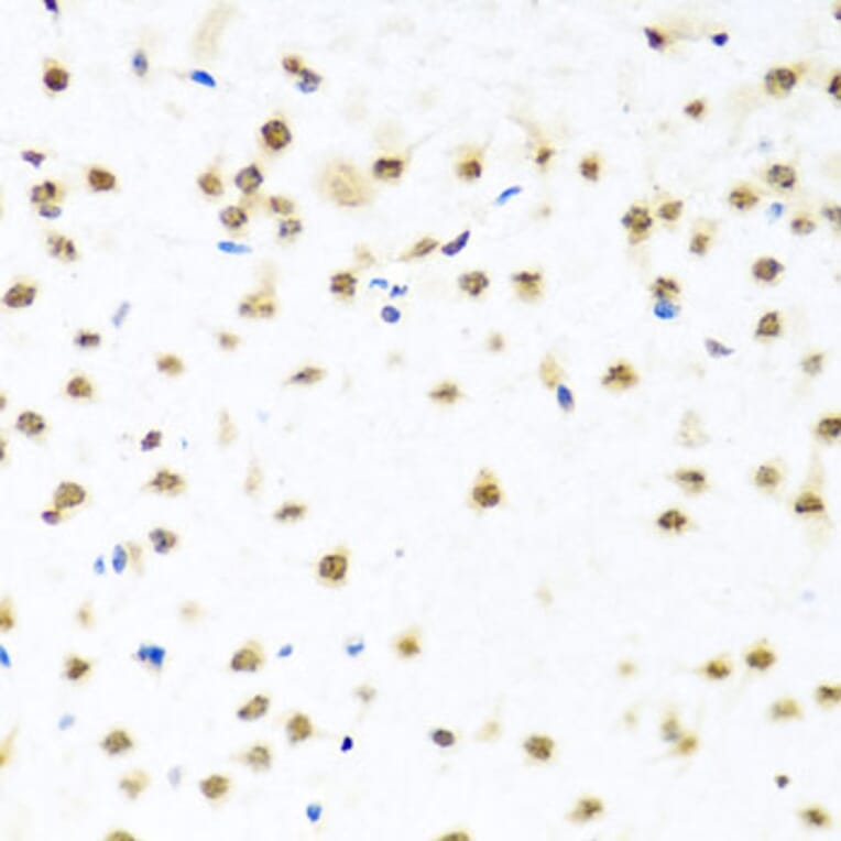 Immunohistochemistry - Anti-RAB3IP Antibody (A8094) - Antibodies.com