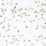 Immunohistochemistry - Anti-RAB3IP Antibody (A8094) - Antibodies.com