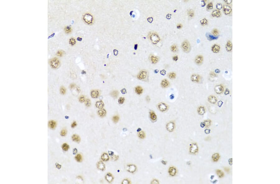 Immunohistochemistry - Anti-RAB3IP Antibody (A8094) - Antibodies.com