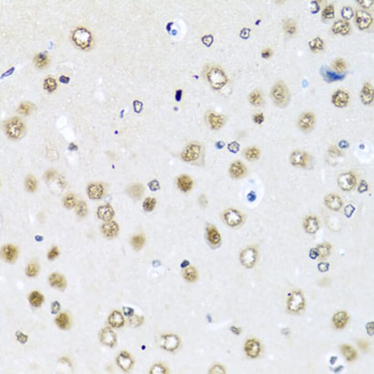 Immunohistochemistry - Anti-RAB3IP Antibody (A8094) - Antibodies.com
