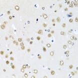 Immunohistochemistry - Anti-RAB3IP Antibody (A8094) - Antibodies.com