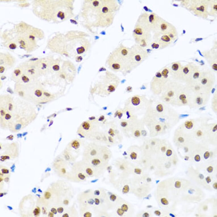 Immunohistochemistry - Anti-RAB3IP Antibody (A8094) - Antibodies.com