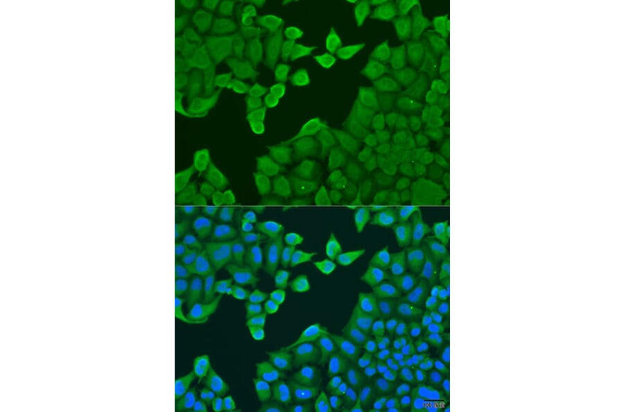 Immunofluorescence - Anti-ARF3 Antibody (A8101) - Antibodies.com