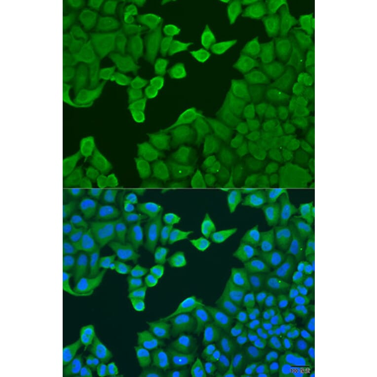 Immunofluorescence - Anti-ARF3 Antibody (A8101) - Antibodies.com