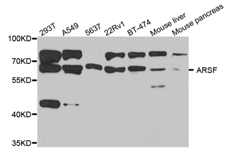 Western Blot - Anti-ARSF Antibody (A8102) - Antibodies.com