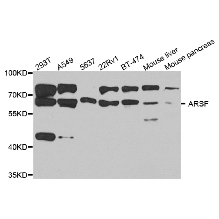 Western Blot - Anti-ARSF Antibody (A8102) - Antibodies.com