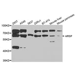Western Blot - Anti-ARSF Antibody (A8102) - Antibodies.com