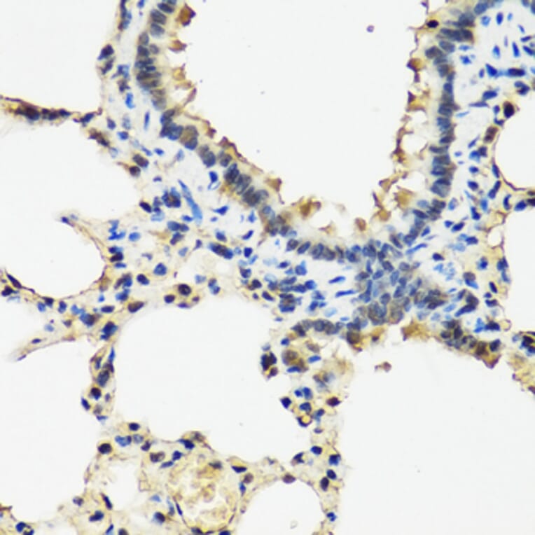 Immunohistochemistry - Anti-ARSF Antibody (A8102) - Antibodies.com