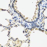 Immunohistochemistry - Anti-ARSF Antibody (A8102) - Antibodies.com