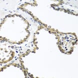 Immunohistochemistry - Anti-ARSF Antibody (A8102) - Antibodies.com