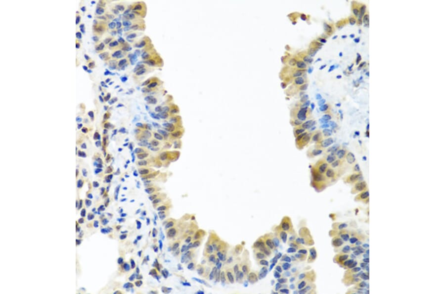 Immunohistochemistry - Anti-ARSF Antibody (A8102) - Antibodies.com