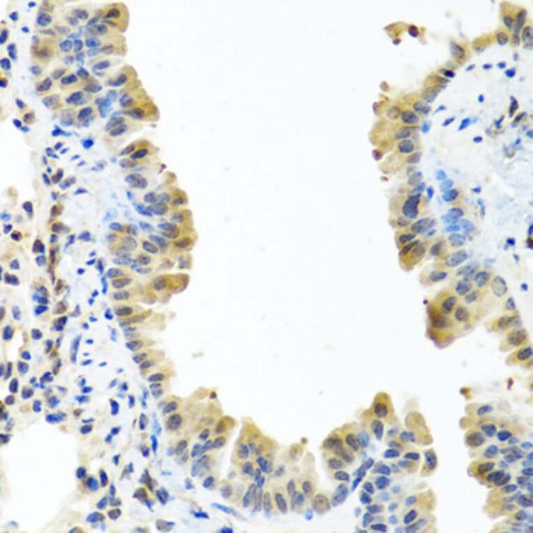 Immunohistochemistry - Anti-ARSF Antibody (A8102) - Antibodies.com