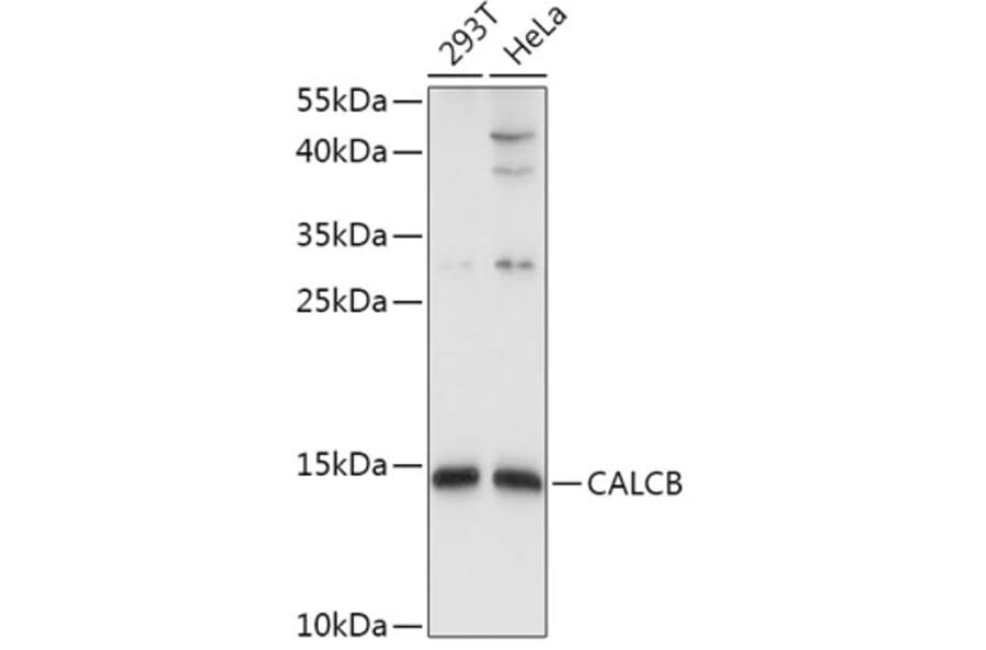 Western Blot - Anti-CALCB Antibody (A8105) - Antibodies.com