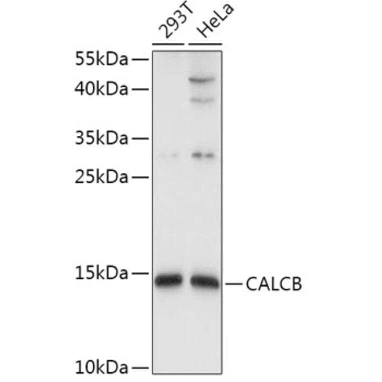 Western Blot - Anti-CALCB Antibody (A8105) - Antibodies.com
