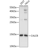 Western Blot - Anti-CALCB Antibody (A8105) - Antibodies.com
