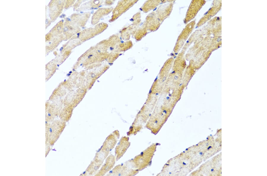 Immunohistochemistry - Anti-CALCB Antibody (A8105) - Antibodies.com
