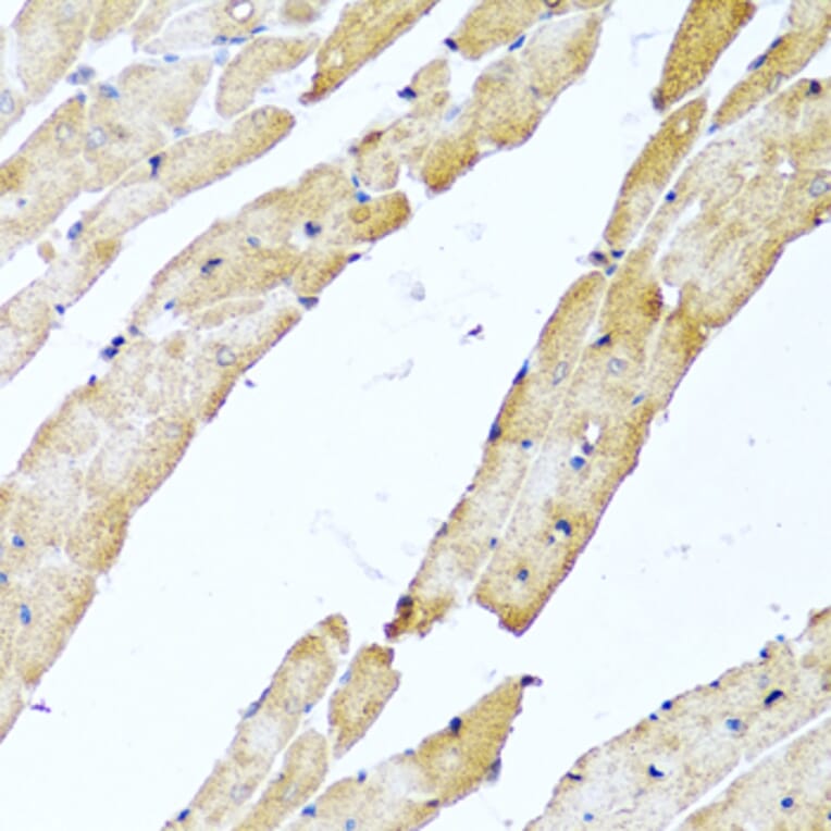 Immunohistochemistry - Anti-CALCB Antibody (A8105) - Antibodies.com