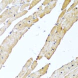 Immunohistochemistry - Anti-CALCB Antibody (A8105) - Antibodies.com