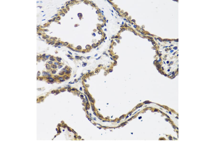 Immunohistochemistry - Anti-CALCB Antibody (A8105) - Antibodies.com