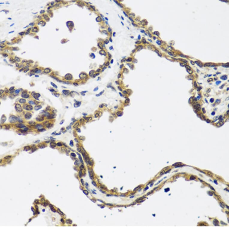 Immunohistochemistry - Anti-CALCB Antibody (A8105) - Antibodies.com