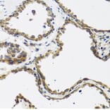 Immunohistochemistry - Anti-CALCB Antibody (A8105) - Antibodies.com