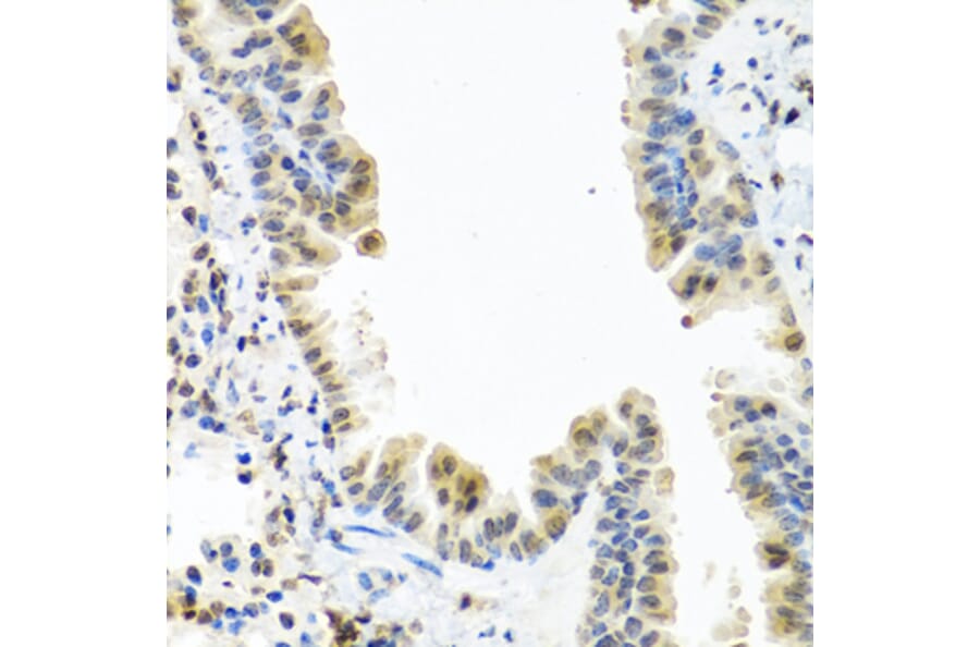 Immunohistochemistry - Anti-CALCB Antibody (A8105) - Antibodies.com