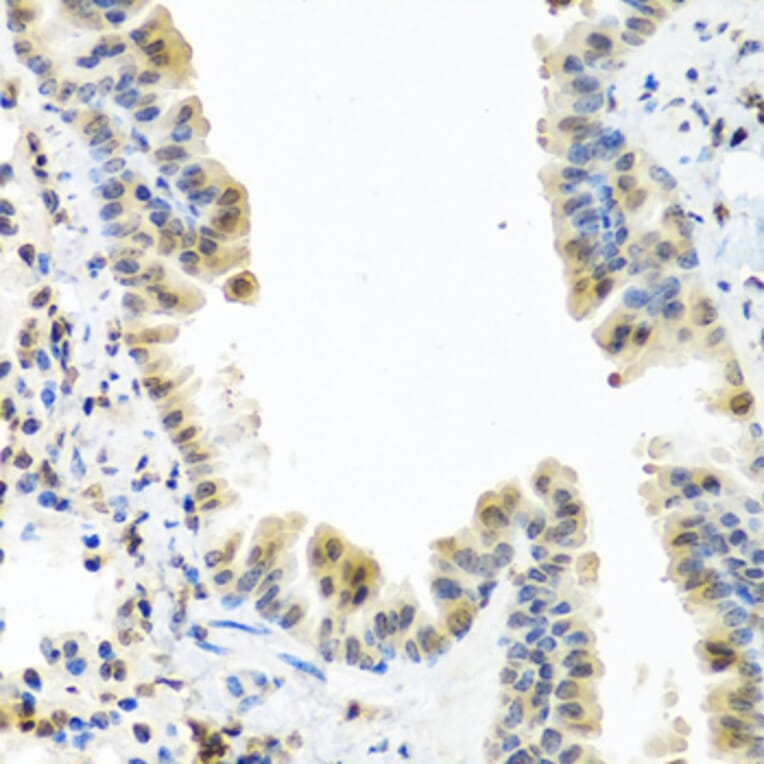 Immunohistochemistry - Anti-CALCB Antibody (A8105) - Antibodies.com